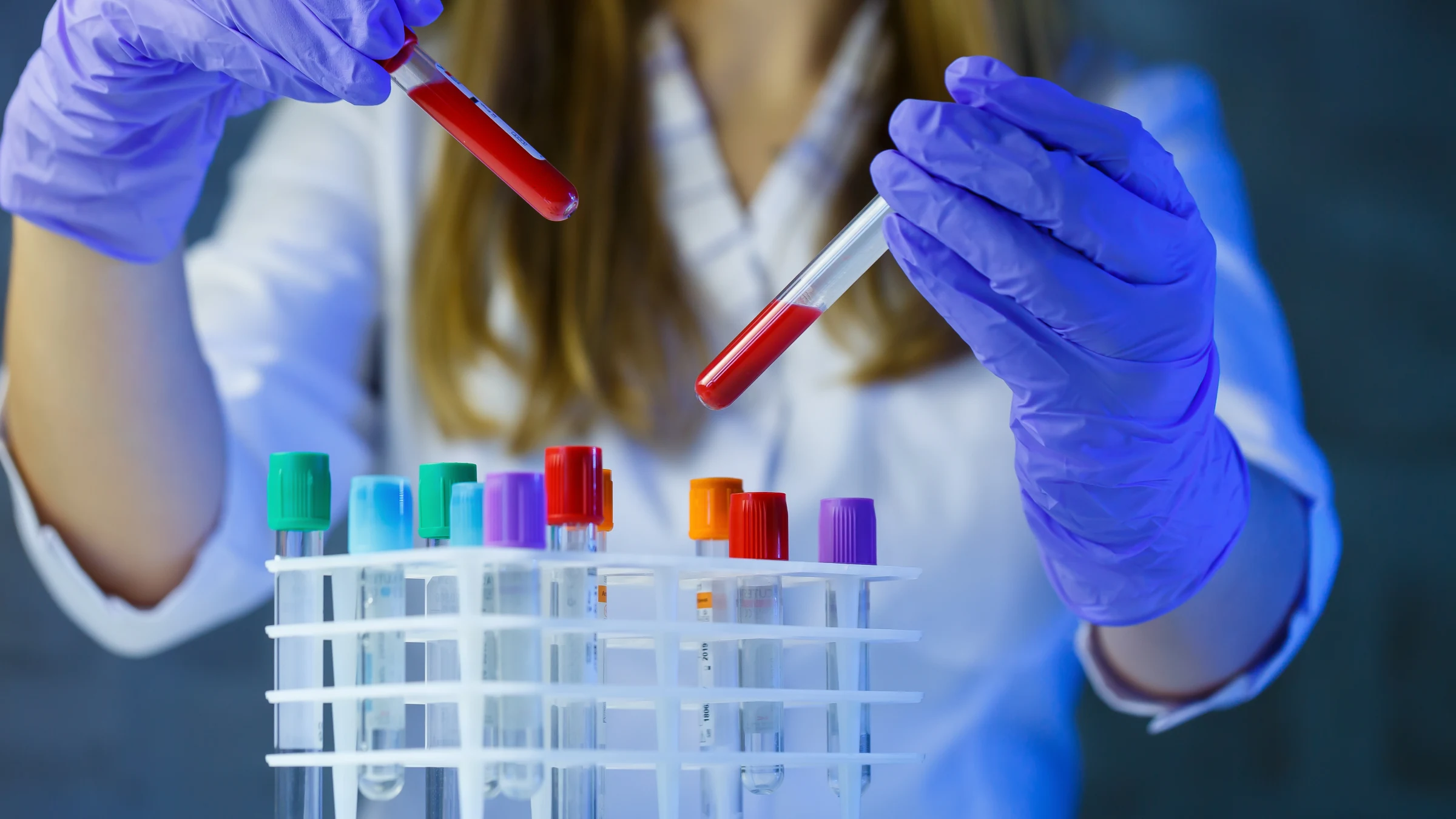 Rows of laboratory test tubes containing coloured liquid samples.